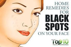 Collection image for: FACE DARK SPOTS REMOVERS